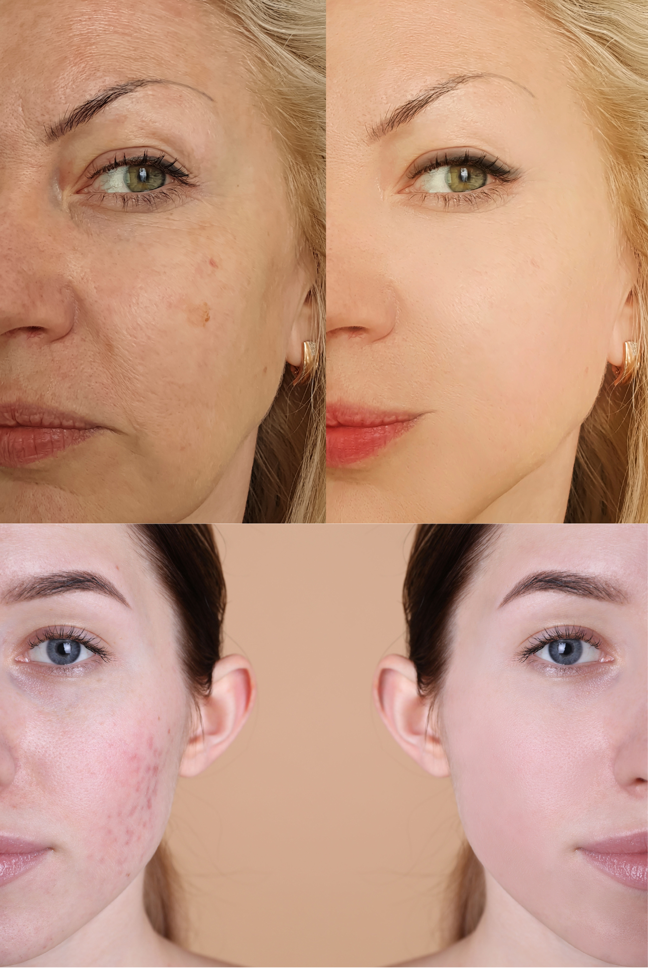 Turmeric Kojic Acid Skin Brightening Bundle (2 bars of soap, 1 jar of scrub, 1  (8oz) oil)